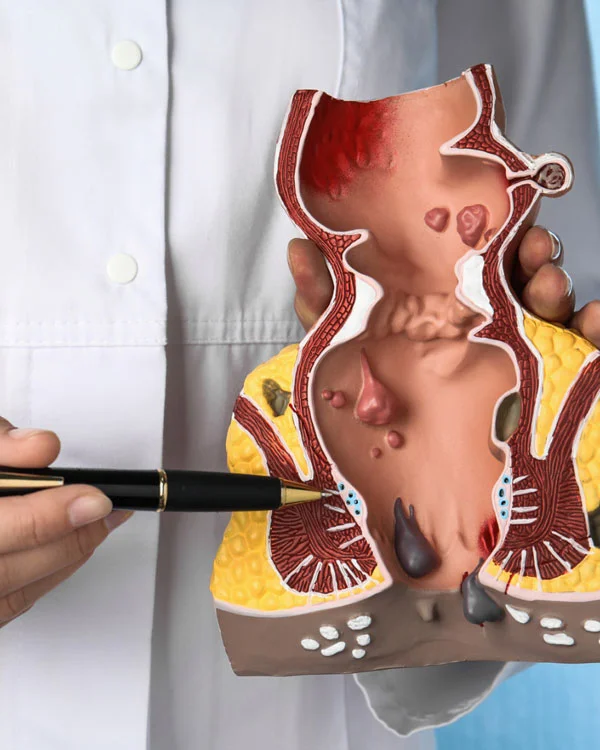 Procedimientos en Coloproctología
