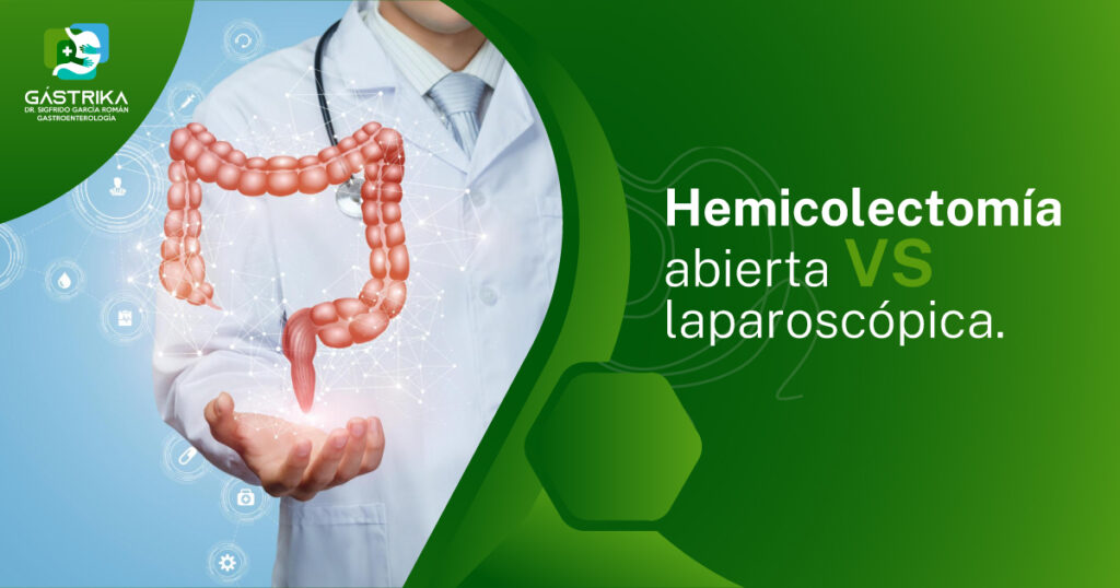 Hemicolectomía abierta vs laparoscópica